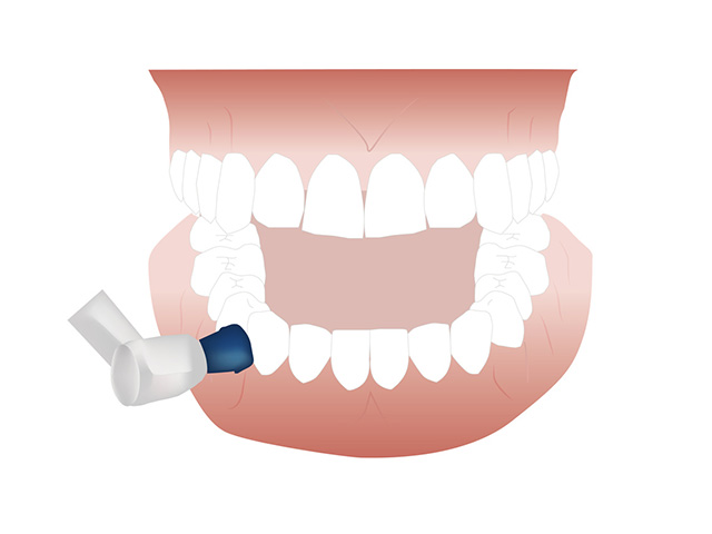 歯周病は予防が第一！ イメージ画像